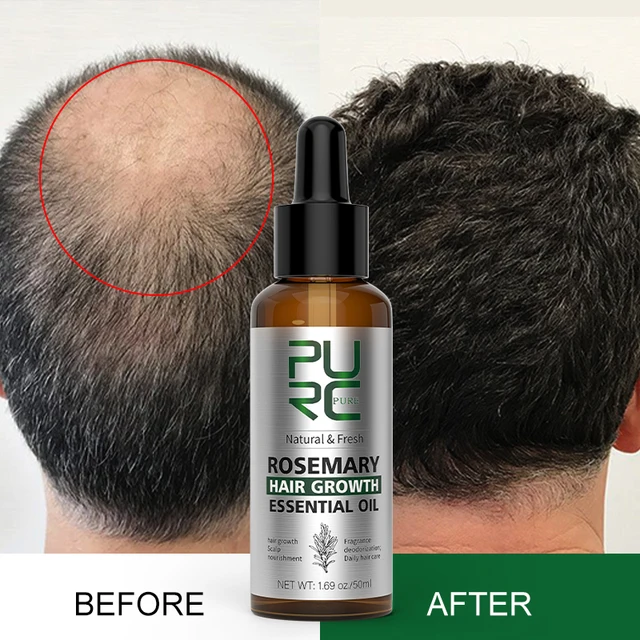 Rosemary Oil Hair Growth